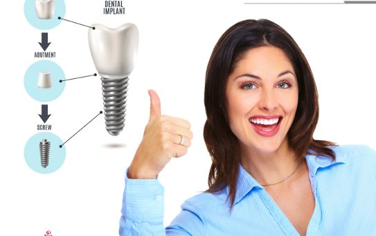 Dental Implant
